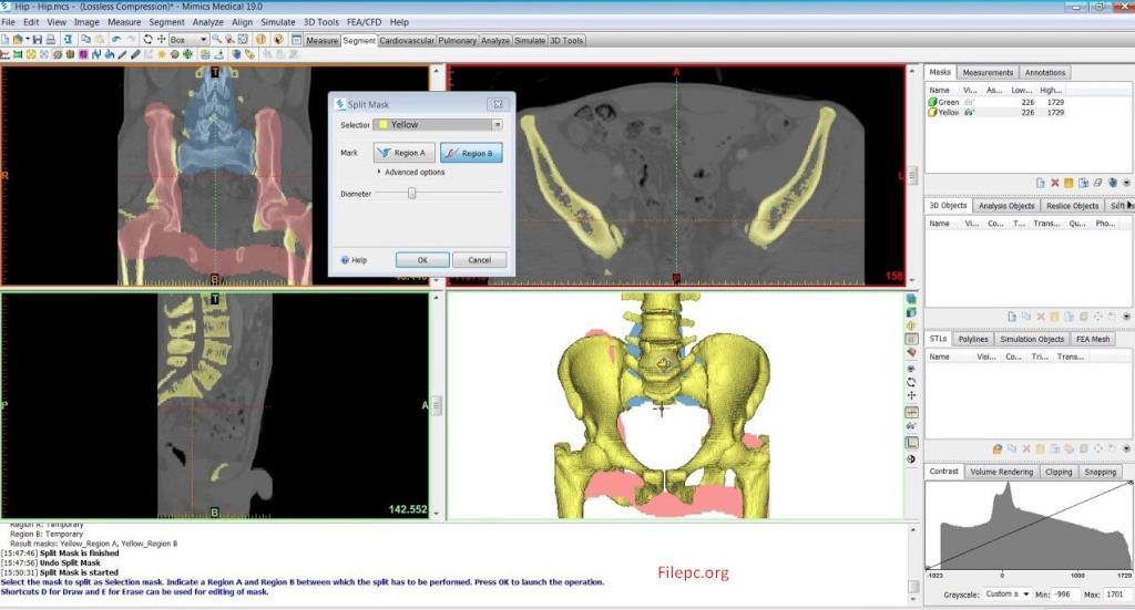 Materialize Mimics Innovation Suite Crack